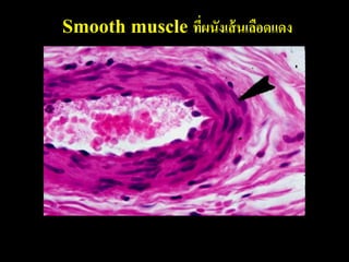 Smooth muscle ทีผนังเส้ นเลือดแดง
                ่
 