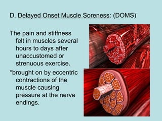 D. Delayed Onset Muscle Soreness: (DOMS)
The pain and stiffness
felt in muscles several
hours to days after
unaccustomed or
strenuous exercise.
*brought on by eccentric
contractions of the
muscle causing
pressure at the nerve
endings.
 