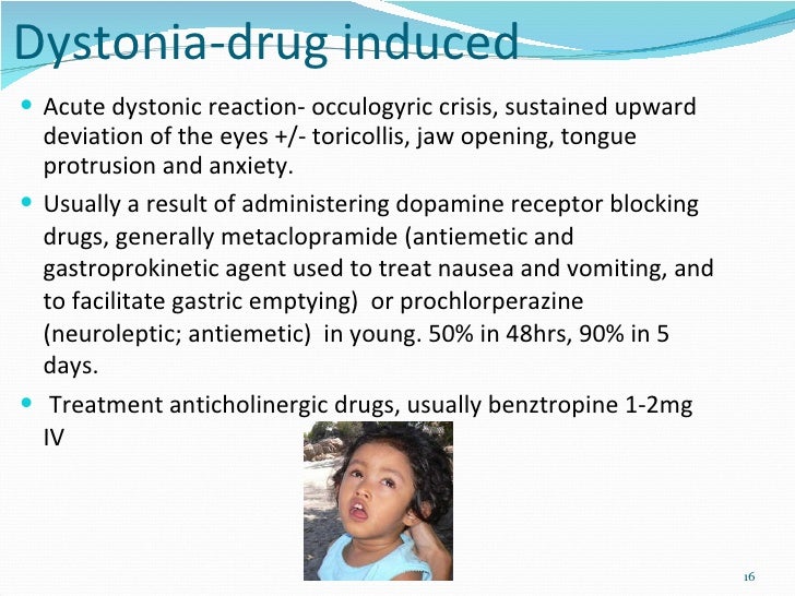 Movement disorders lecture