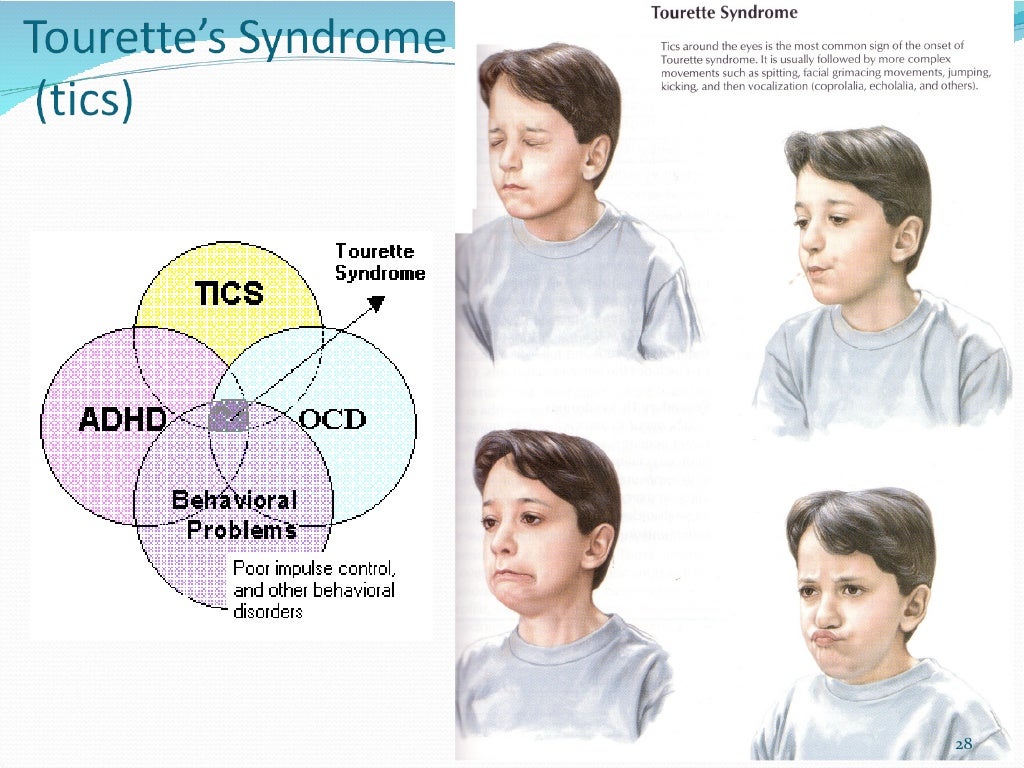 Movement disorders lecture