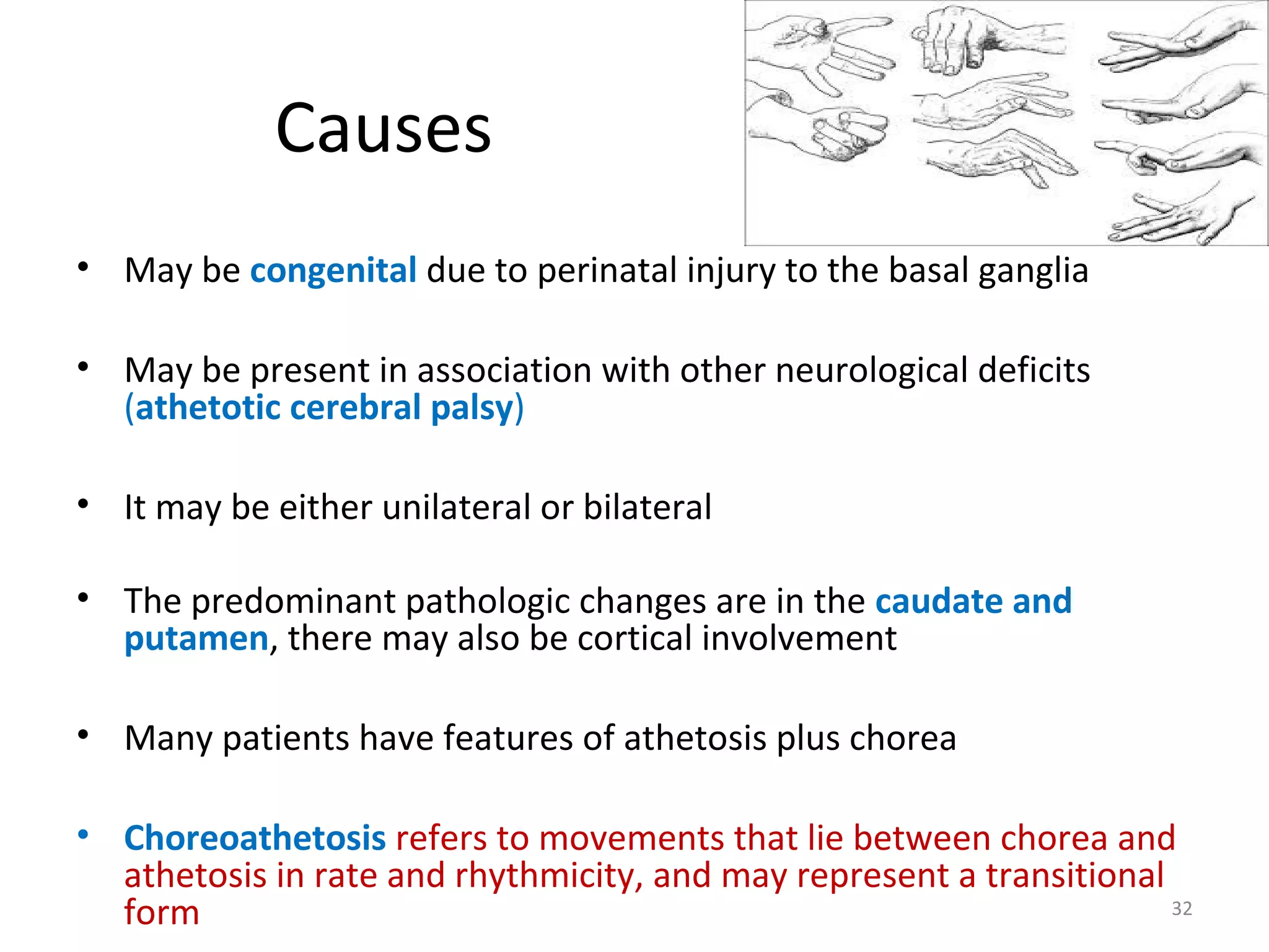 Causes
• May be congenital due to perinatal injury to the basal ganglia
• May be present in association with other neurological deficits
(athetotic cerebral palsy)
• It may be either unilateral or bilateral
• The predominant pathologic changes are in the caudate and
putamen, there may also be cortical involvement
• Many patients have features of athetosis plus chorea
• Choreoathetosis refers to movements that lie between chorea and
athetosis in rate and rhythmicity, and may represent a transitional
form 32
 