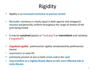 Human Body Rigidity Movement disorders | PPT