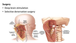 Surgery
• Deep brain stimulation
• Selective denervation surgery
 