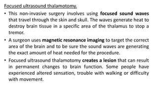 Focused ultrasound thalamotomy.
• This non-invasive surgery involves using focused sound waves
that travel through the skin and skull. The waves generate heat to
destroy brain tissue in a specific area of the thalamus to stop a
tremor.
• A surgeon uses magnetic resonance imaging to target the correct
area of the brain and to be sure the sound waves are generating
the exact amount of heat needed for the procedure.
• Focused ultrasound thalamotomy creates a lesion that can result
in permanent changes to brain function. Some people have
experienced altered sensation, trouble with walking or difficulty
with movement.
 