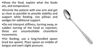 •Show the food, explain what the foods
are, and temperature.
•Encircle the patient with one arm and get
as close as possible to provide stability and
support while feeding. Use pillows and
wedges for additional support.
•Do not interpret stiffness, turning away, or
sudden turning of the head as rejection;
these are uncontrollable choreiform
movements.
•For feeding, use a long-handled spoon
(iced tea spoon). Place spoon on middle of
tongue and exert slight pressure.
 