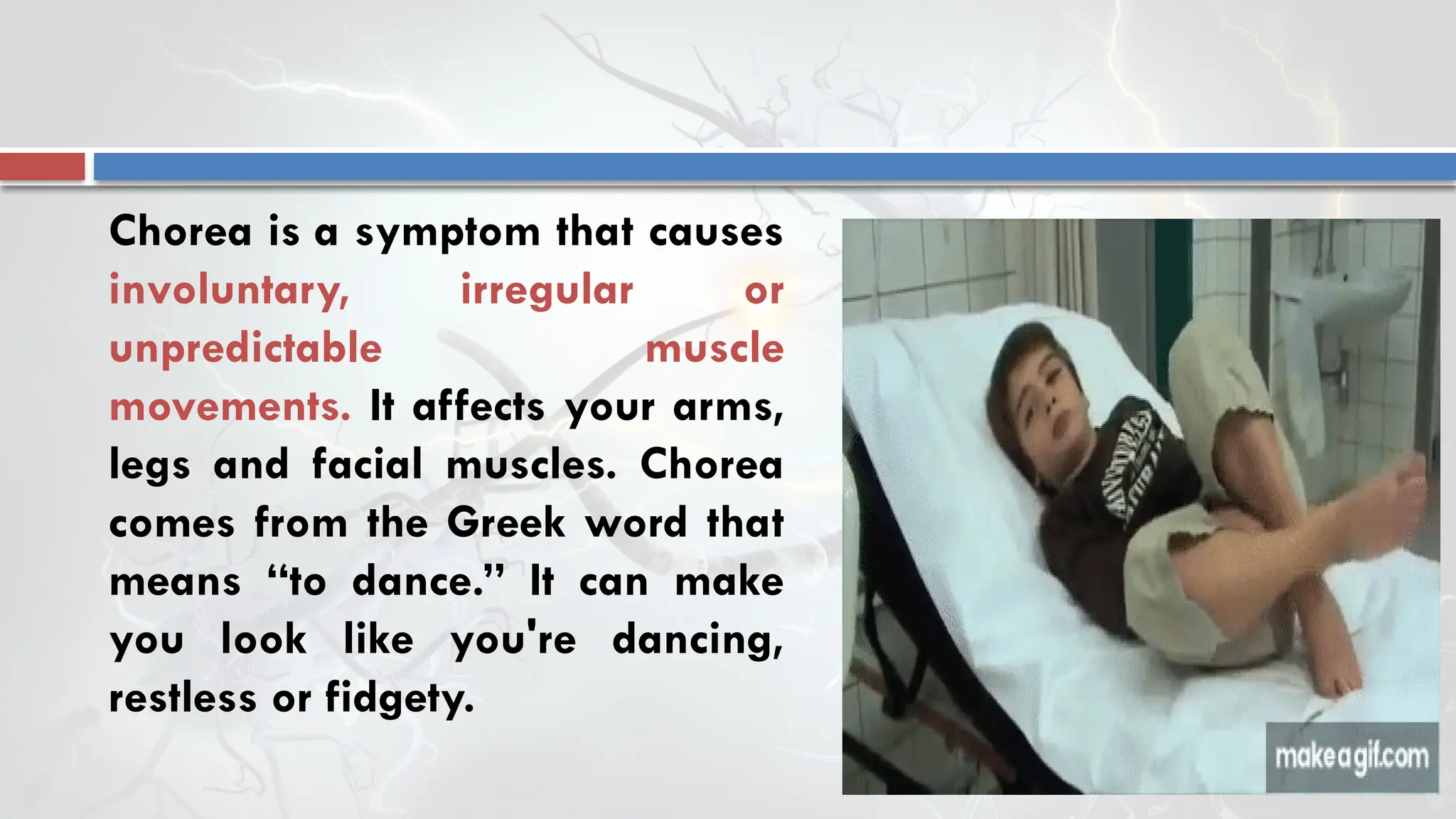 Chorea is a symptom that causes
involuntary, irregular or
unpredictable muscle
movements. It affects your arms,
legs and facial muscles. Chorea
comes from the Greek word that
means “to dance.” It can make
you look like you're dancing,
restless or fidgety.
 