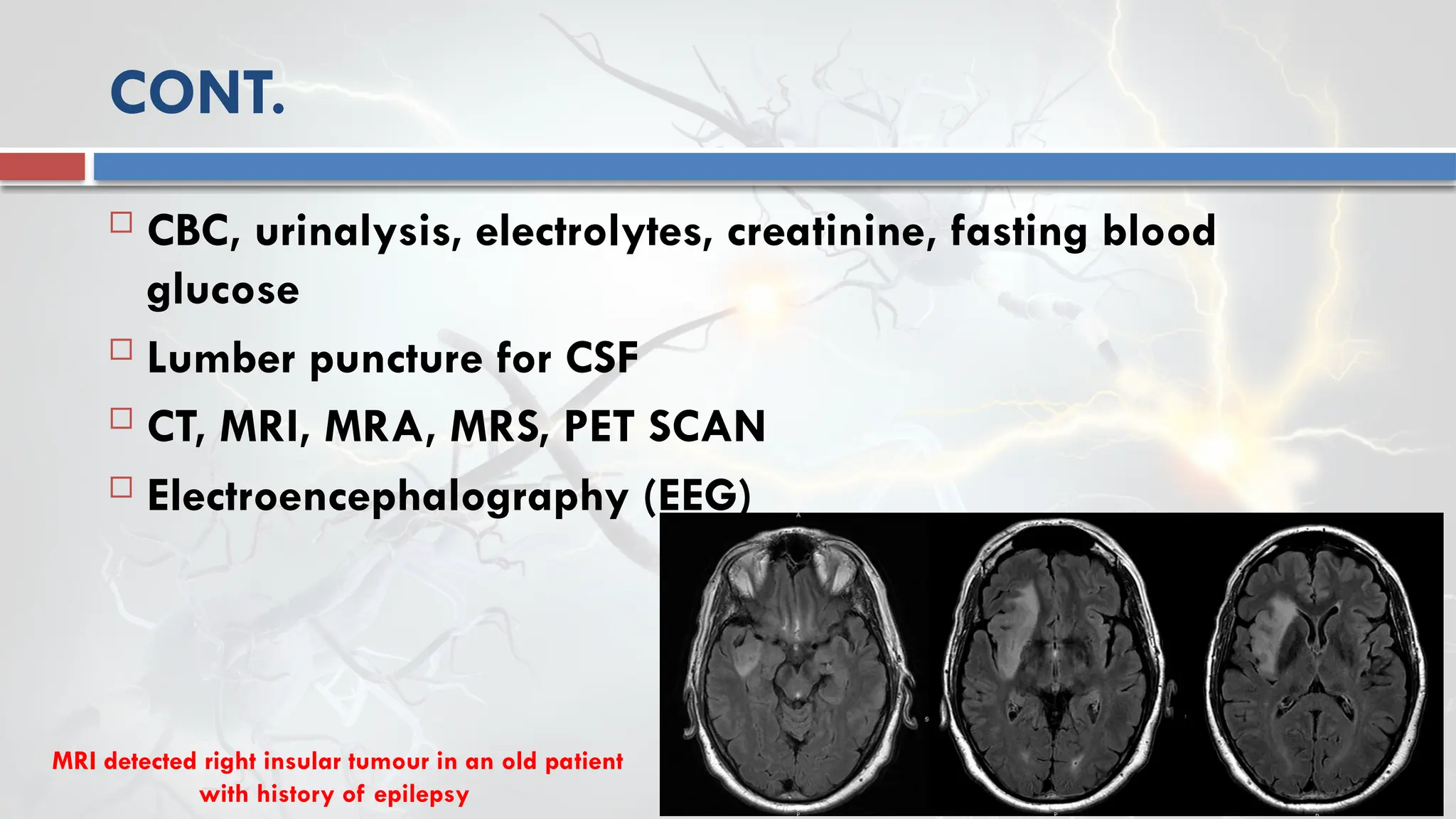  CBC, urinalysis, electrolytes, creatinine, fasting blood
glucose
 Lumber puncture for CSF
 CT, MRI, MRA, MRS, PET SCAN
 Electroencephalography (EEG)
CONT.
MRI detected right insular tumour in an old patient
with history of epilepsy
 