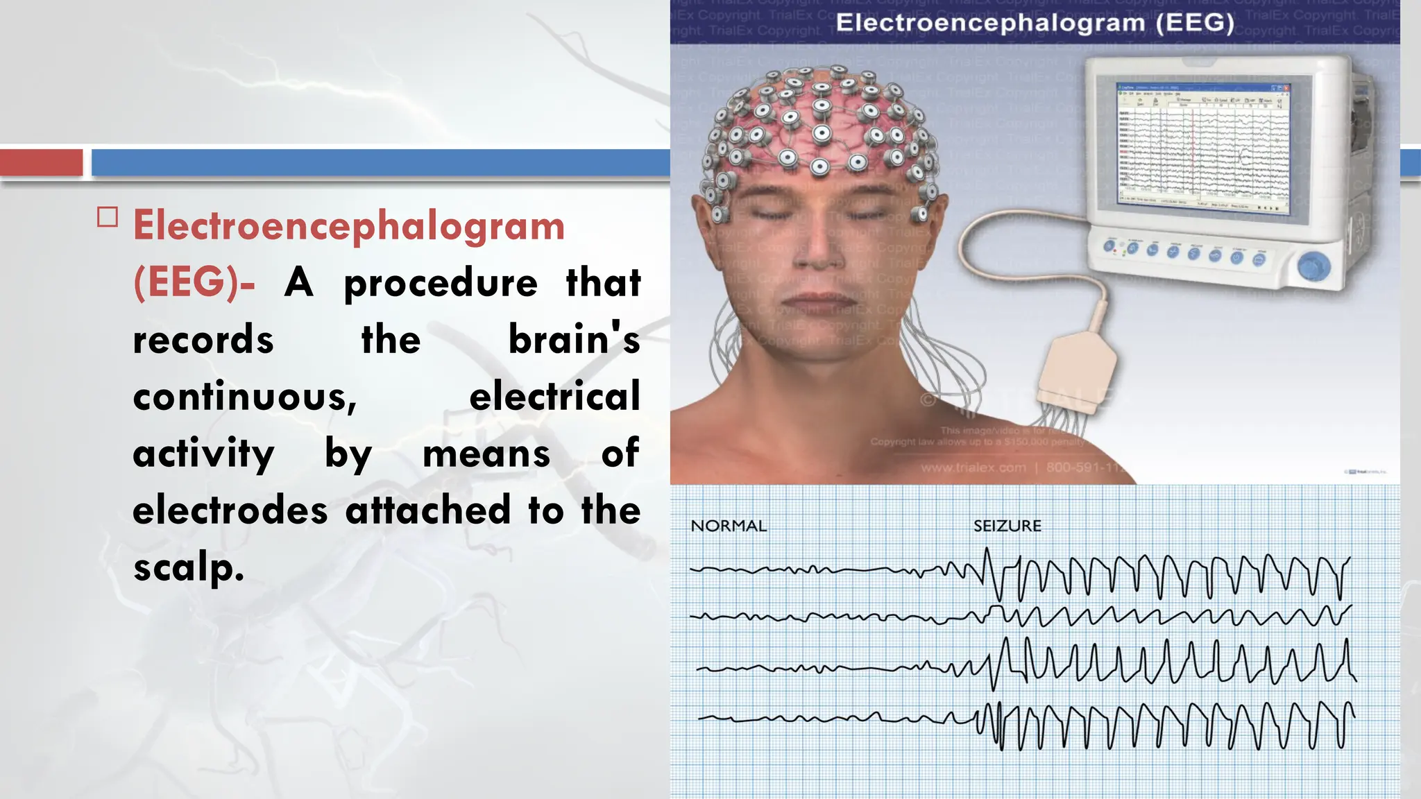  Electroencephalogram
(EEG)- A procedure that
records the brain's
continuous, electrical
activity by means of
electrodes attached to the
scalp.
 