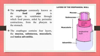  The esophagus commonly known as
the food pipe is
an organ in vertebrates through
which food passes, aided by peristaltic
contractions, from the pharynx to
the stomach.
 The esophagus contains four layers,
the mucosa, submucosa, muscularis,
and tunica adventitia.
 