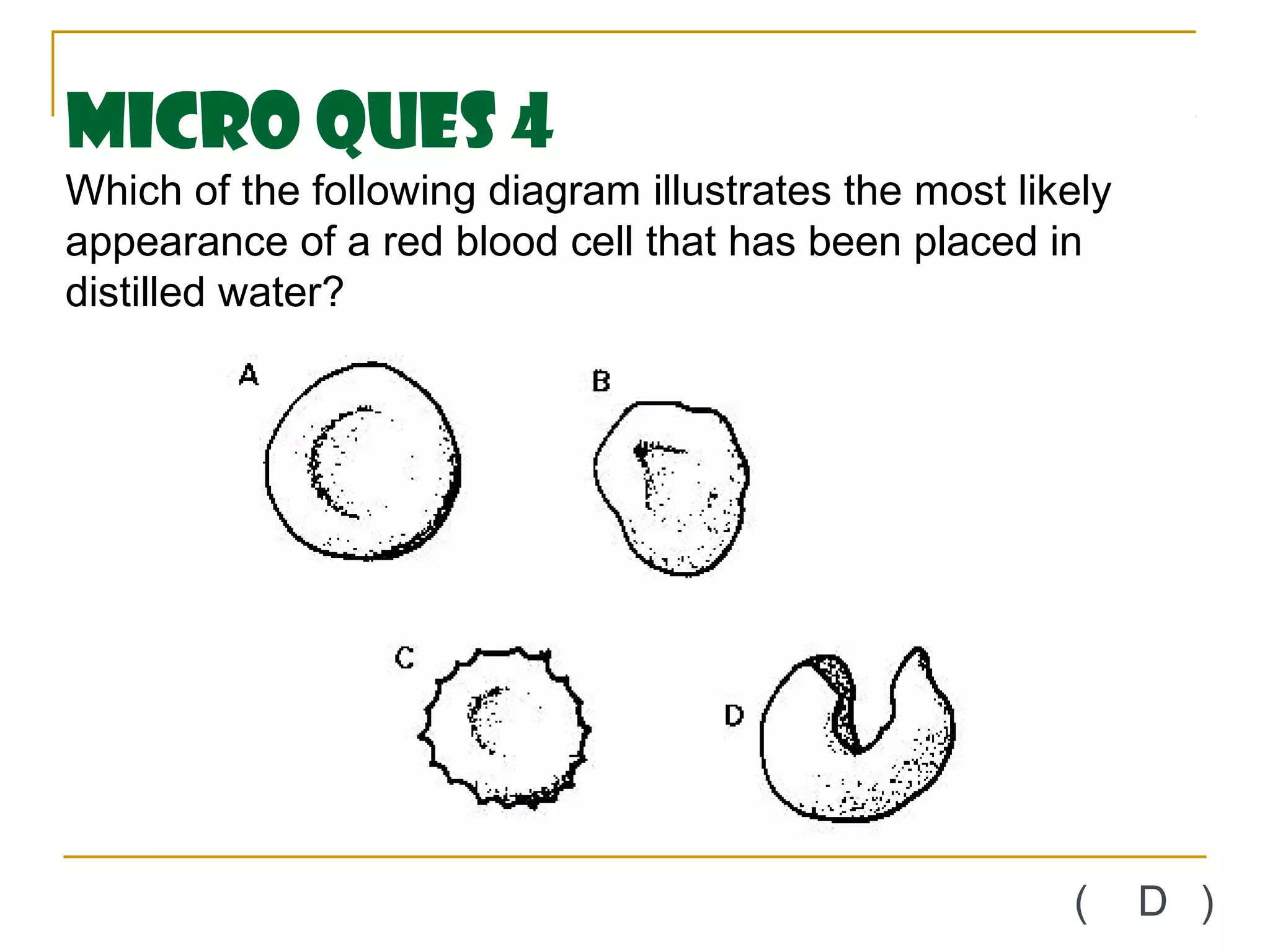 Micro Ques 4
Which of the following diagram illustrates the most likely
appearance of a red blood cell that has been placed in
distilled water?




                                                       (     D )
 