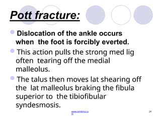 Pottys Fructure Details - of - movements-ankle-joint.pptx