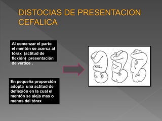 Al comenzar el parto
el mentón se acerca al
tórax (actitud de
flexión) presentación
de vértice .
En pequeña proporción
adopta una actitud de
deflexión en la cual el
mentón se aleja mas o
menos del tórax
 