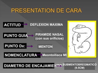ACTITUD
PUNTO GUIA
PUNTO Dx:
NOMENCLATURA
DIAMETRO DE ENCAJAMIENTO
DEFLEXION MAXIMA
PIRAMIDE NASAL
(con sus orificios)
MENTON
Meontoiliaca MI
SUBMENTOBREGMATICO
(9.5CM)
 