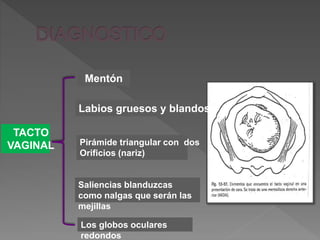 Mentón
Labios gruesos y blandos
Pirámide triangular con dos
Orificios (nariz)
Saliencias blanduzcas
como nalgas que serán las
mejillas
Los globos oculares
redondos
TACTO
VAGINAL
 