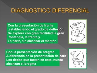 Con la presentación de frente
.estableciendo el grado de deflexión
Se explora con gran facilidad la gran
fontanela, la frente y
La nariz, sin alcanzar el mentón
Con la presentación de bregma
A diferencia de la presentación de cara
Los dedos que tactan en esta ,nunca
alcanzan el bregma
 