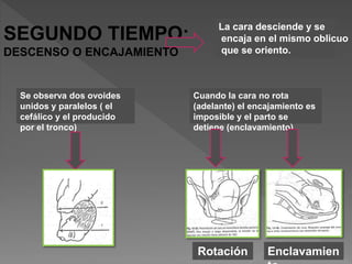 SEGUNDO TIEMPO:
DESCENSO O ENCAJAMIENTO
La cara desciende y se
encaja en el mismo oblicuo
que se oriento.
Se observa dos ovoides
unidos y paralelos ( el
cefálico y el producido
por el tronco)
Cuando la cara no rota
(adelante) el encajamiento es
imposible y el parto se
detiene (enclavamiento)
Rotación Enclavamien
 