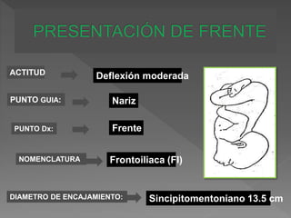 ACTITUD
PUNTO GUIA:
PUNTO Dx:
NOMENCLATURA
DIAMETRO DE ENCAJAMIENTO:
Deflexión moderada
Nariz
Frente
Frontoiliaca (FI)
Sincipitomentoniano 13.5 cm
 