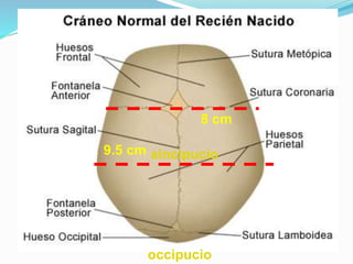 9.5 cm
8 cm
sincipucio
occipucio
 