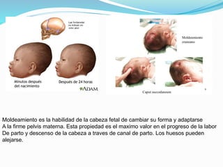 Moldeamiento es la habilidad de la cabeza fetal de cambiar su forma y adaptarse
A la firme pelvis materna. Esta propiedad es el maximo valor en el progreso de la labor
De parto y descenso de la cabeza a traves de canal de parto. Los huesos pueden
alejarse.
 