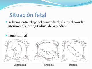 Situación fetal
 Relación entre el eje del ovoide fetal, el eje del ovoide
uterino y el eje longitudinal de la madre.
 Longitudinal
 Transverso
 oblicuo
Longitudinal Transversa Oblicua
 