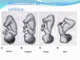 Modalidades de Presentación
cefálica.
vertice bregma frente cara
 