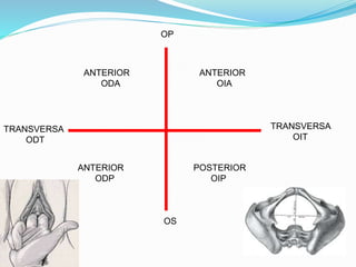 ANTERIOR
OIA
POSTERIOR
OIP
TRANSVERSA
OIT
ANTERIOR
ODA
ANTERIOR
ODP
TRANSVERSA
ODT
OP
OS
 