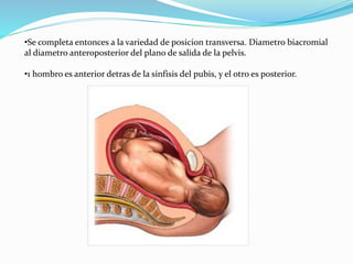 •Se completa entonces a la variedad de posicion transversa. Diametro biacromial
al diametro anteroposterior del plano de salida de la pelvis.
•1 hombro es anterior detras de la sinfisis del pubis, y el otro es posterior.
 