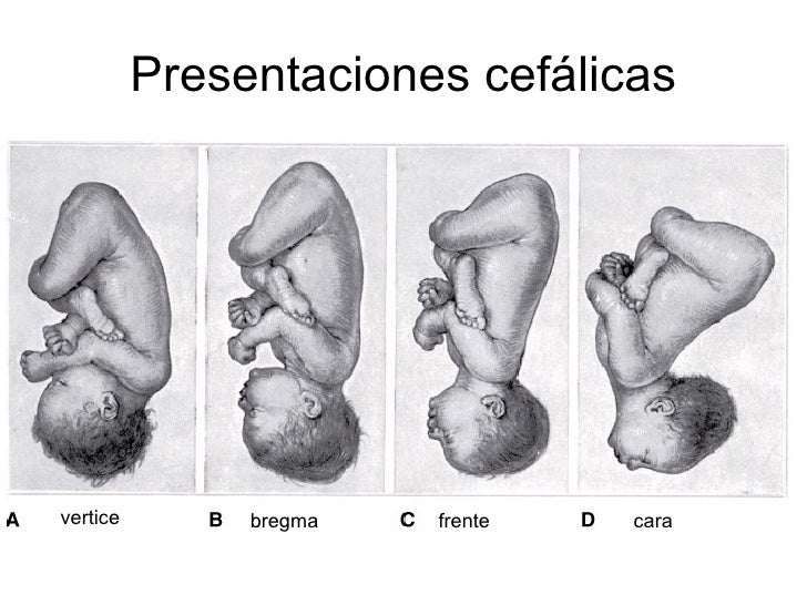 Movil Fetal Y Canal Del Parto