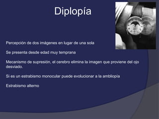 Diplopía 
Percepción de dos imágenes en lugar de una sola 
Se presenta desde edad muy temprana 
Mecanismo de supresión, el cerebro elimina la imagen que proviene del ojo 
desviado. 
Si es un estrabismo monocular puede evolucionar a la ambliopía 
Estrabismo alterno 
 