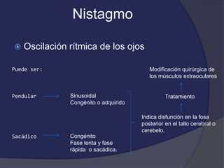 Nistagmo 
 Oscilación rítmica de los ojos 
Puede ser: 
Pendular 
Sacádico 
Sinusoidal 
Congénito o adquirido 
Congénito 
Fase lenta y fase 
rápida o sacádica. 
Modificación quirúrgica de 
los músculos extraoculares 
Tratamiento 
Indica disfunción en la fosa 
posterior en el tallo cerebral o 
cerebelo. 
 