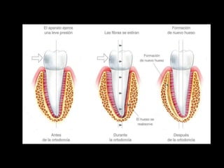 Movimiento ortodoncico