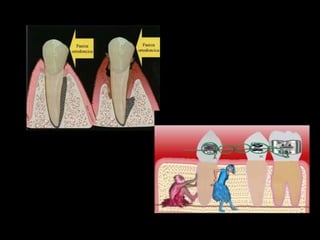 Movimiento ortodoncico