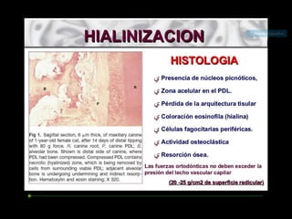 Movimiento ortodoncico