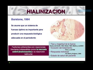 Movimiento ortodoncico