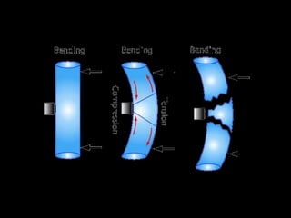 Movimiento ortodoncico