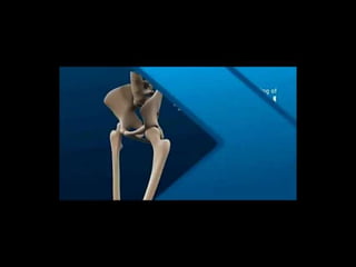 Movimiento ortodoncico