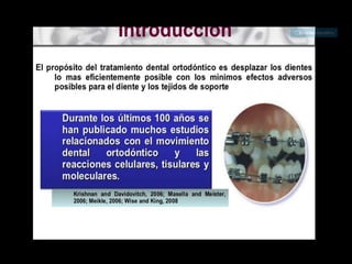 Movimiento ortodoncico