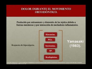 Movimiento ortodoncico