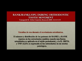 Movimiento ortodoncico