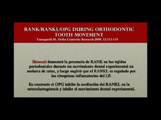 Movimiento ortodoncico