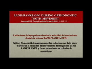 Movimiento ortodoncico