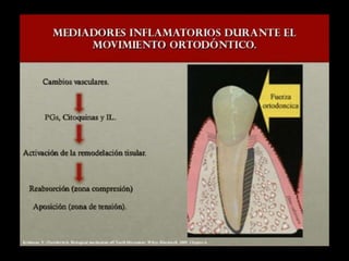 Movimiento ortodoncico