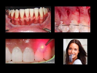 Movimiento ortodoncico