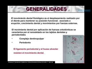 Movimiento ortodoncico