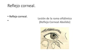 Reflejo corneal.
• Reflejo corneal.
•
 