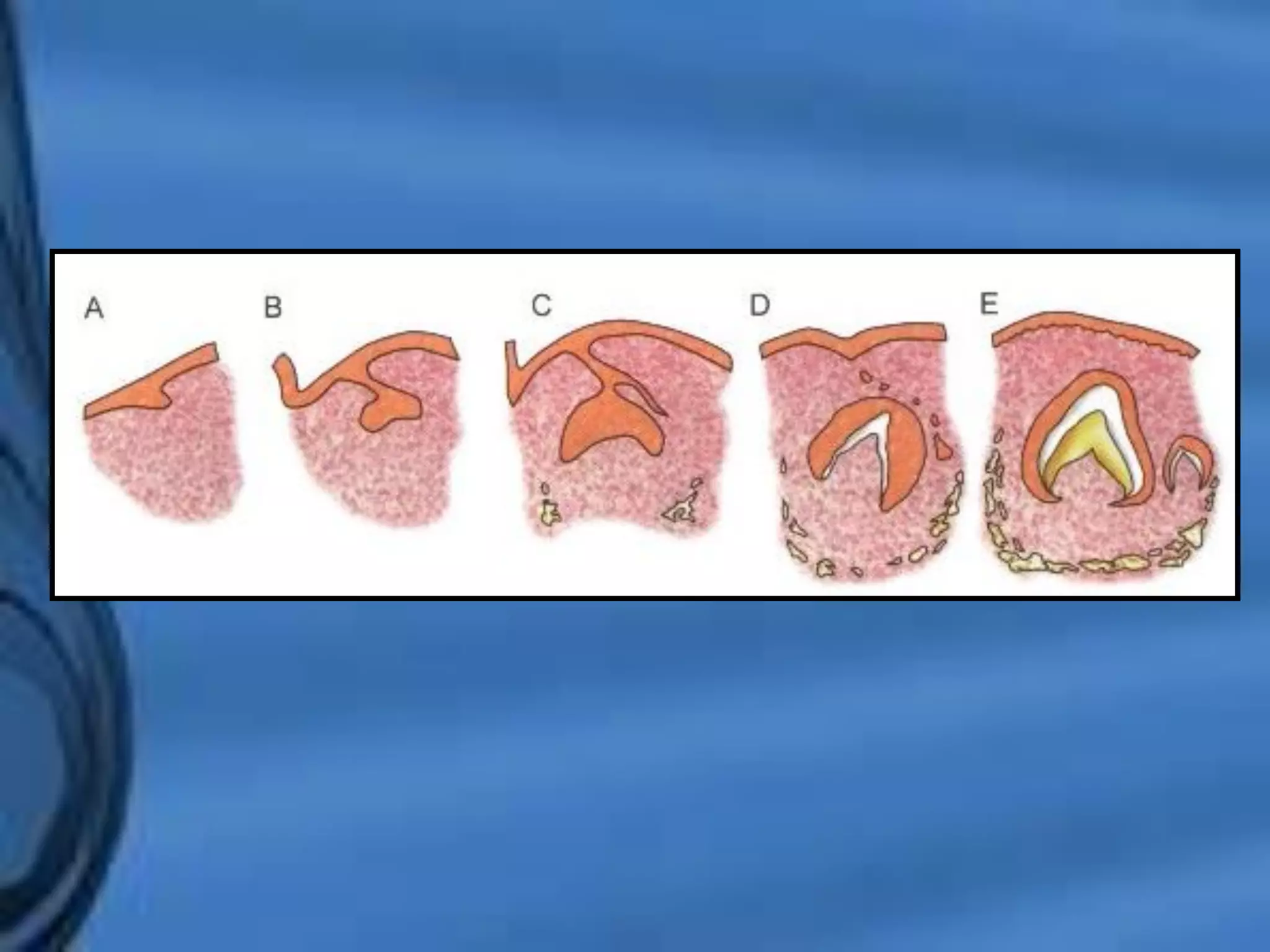 Movimientos Dentarios
