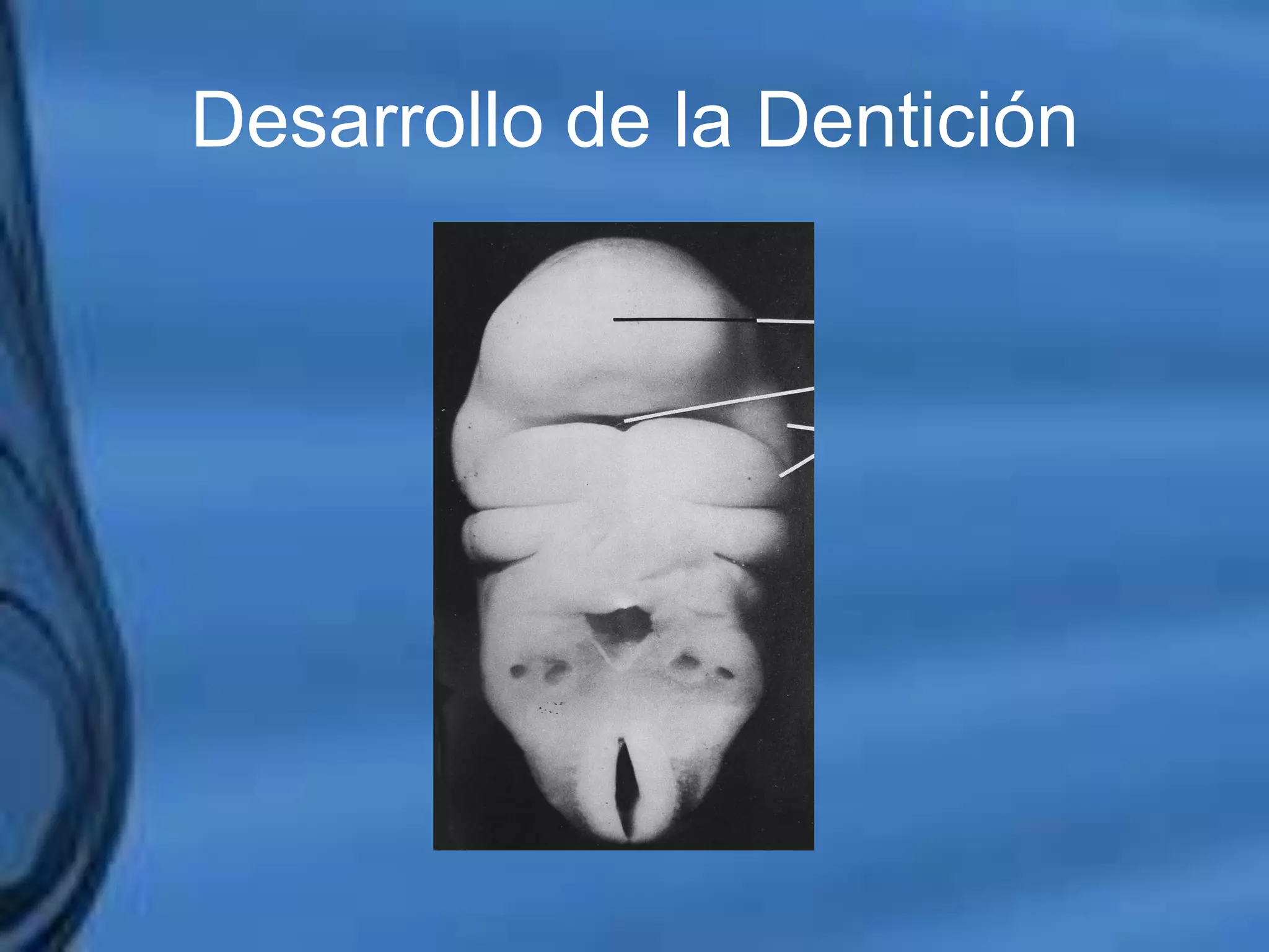 Movimientos Dentarios