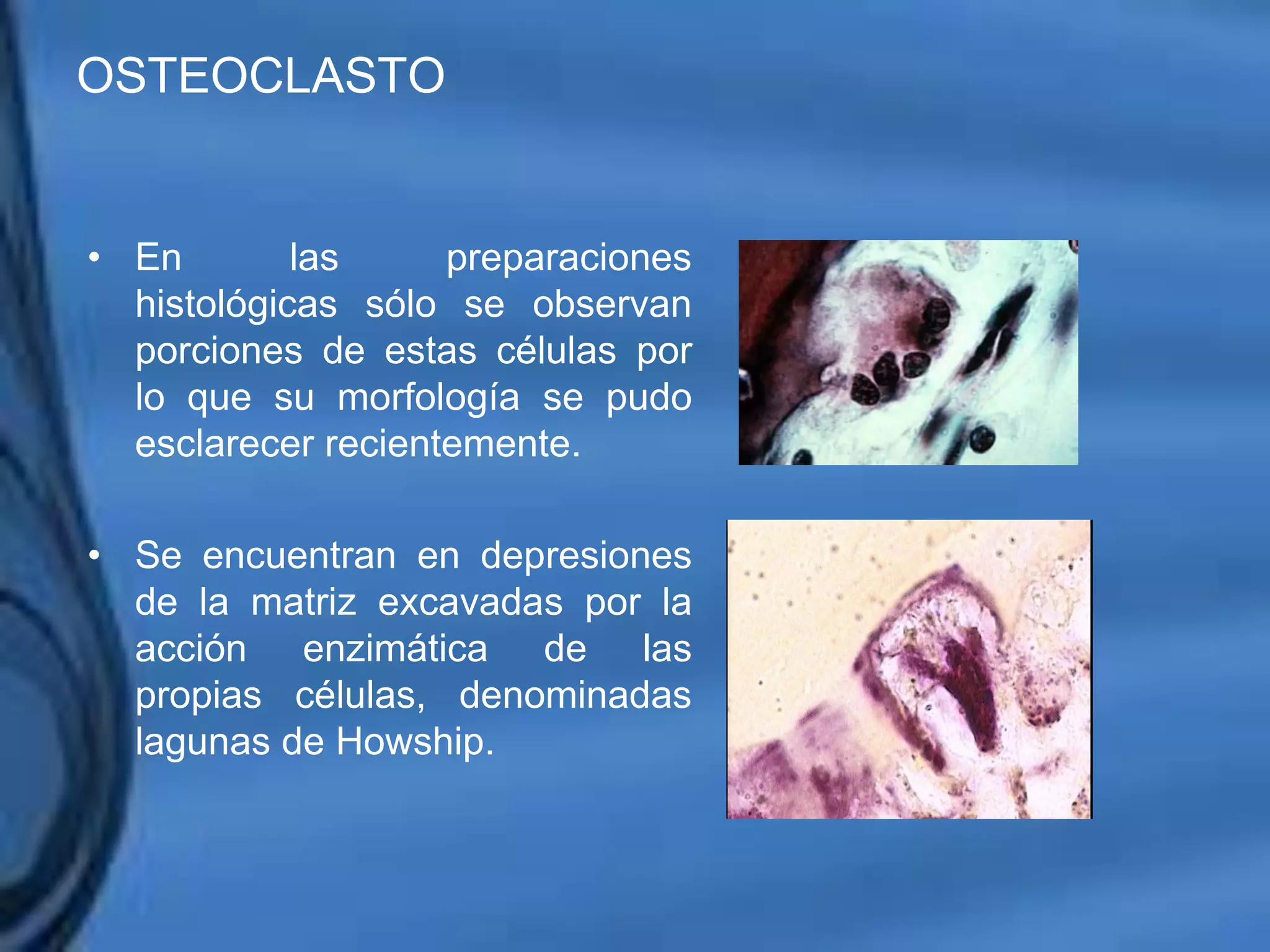 Movimientos Dentarios