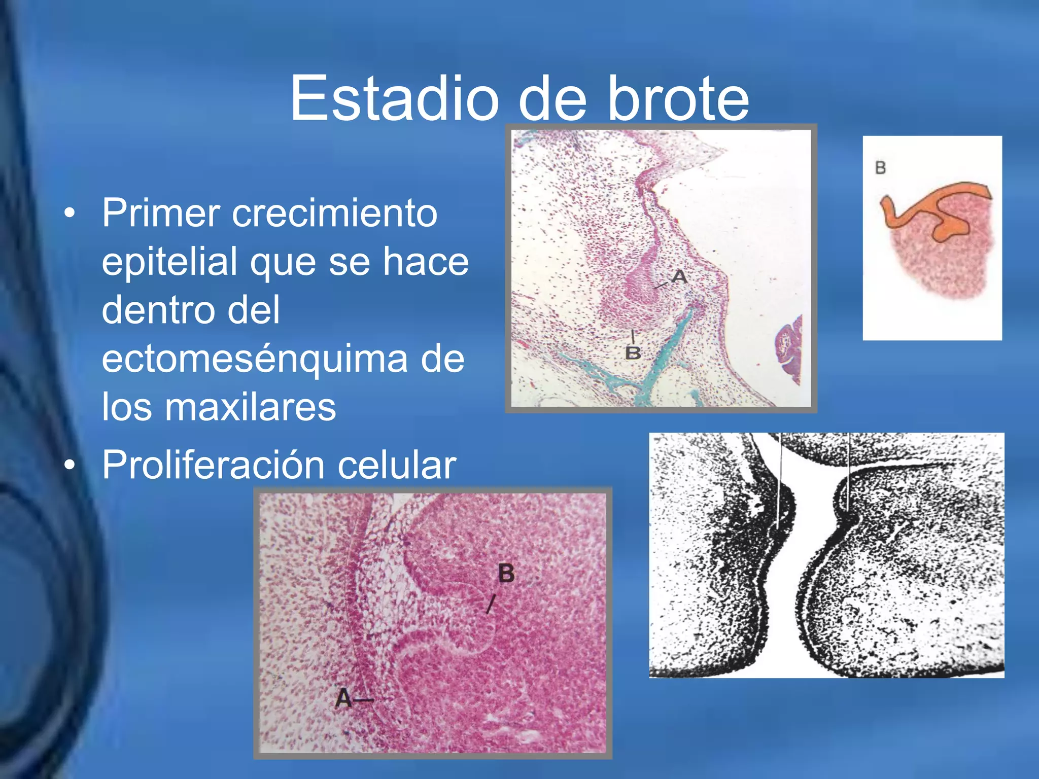 Movimientos Dentarios