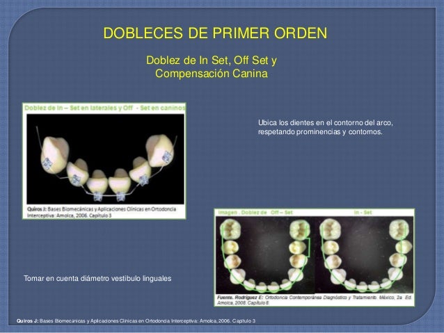 Movimientos dentales